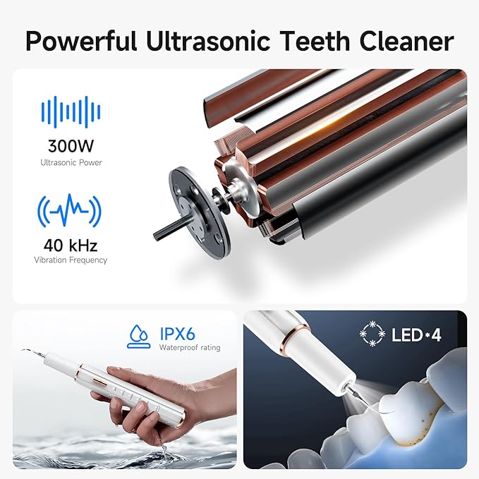 Electric Dog Plaque & Tartar Remover - Pet Teeth Cleaning Kit with 5 Adjustable Modes, LED Light, Safe and Low Noise – Easy at Home Dental Care for Dogs and Cats